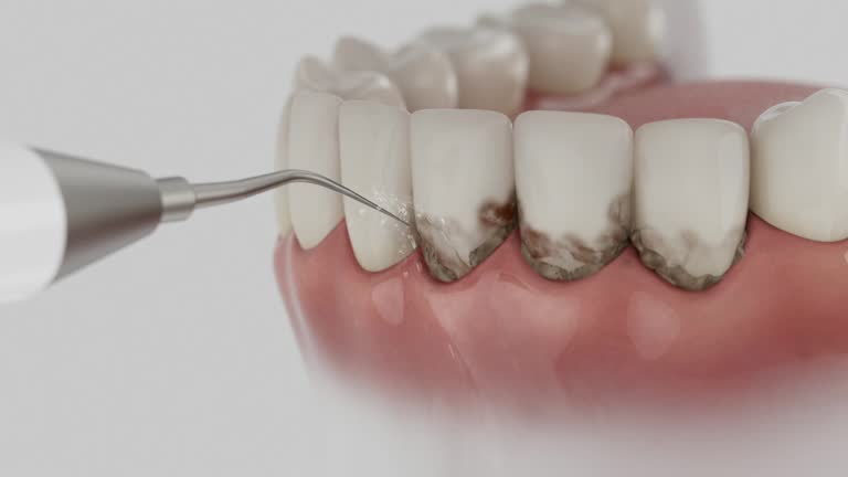 Reliable Teeth Cleaning And Checkup contractor in Morrow County County, OH by Dentist Open Now